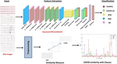 Efficient-ECGNet framework for COVID-19 classification and correlation prediction with the cardio disease through electrocardiogram medical imaging